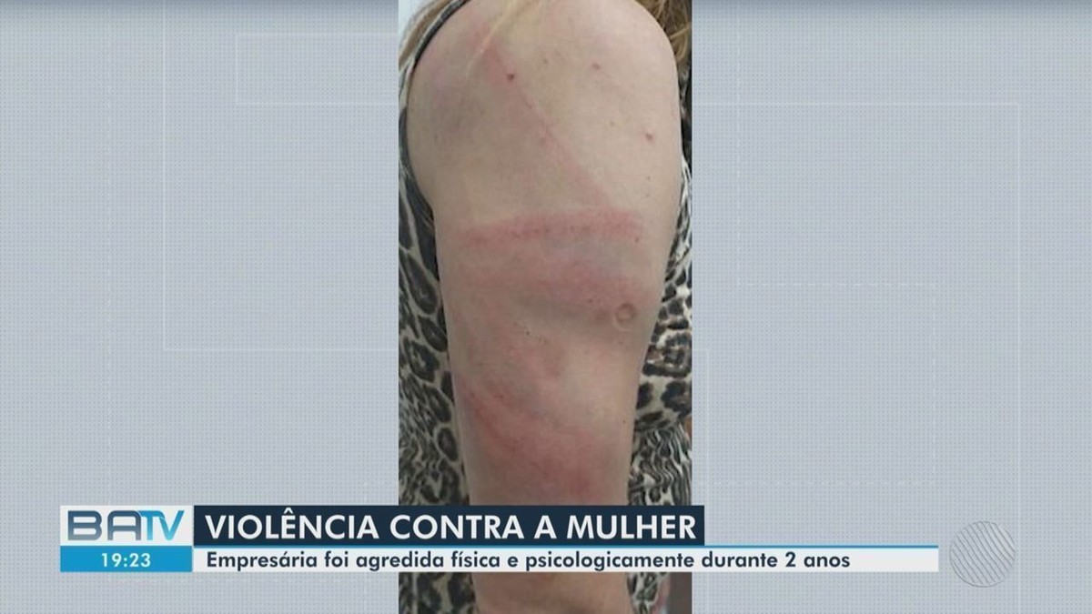 Perda de guarda dos filhos e aborto espontâneo: empresária … – Globo